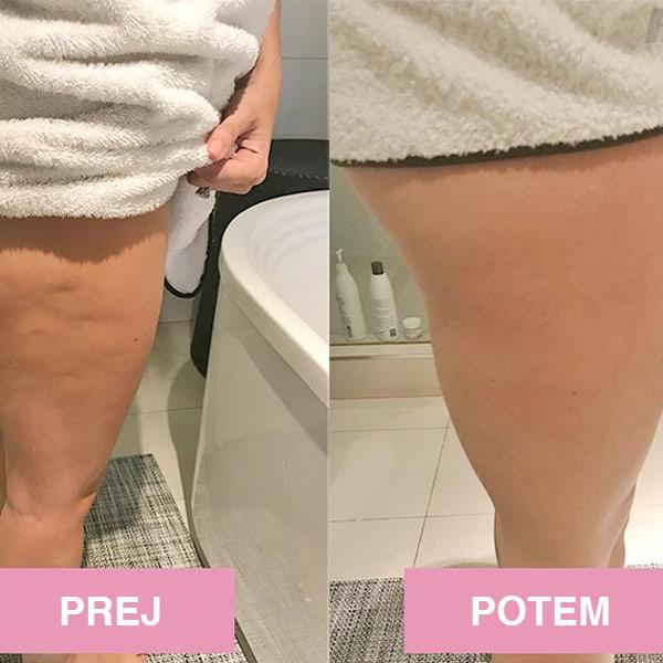 FitRoller, inovativni 4-točkovni masažni pripomoček za fit telo