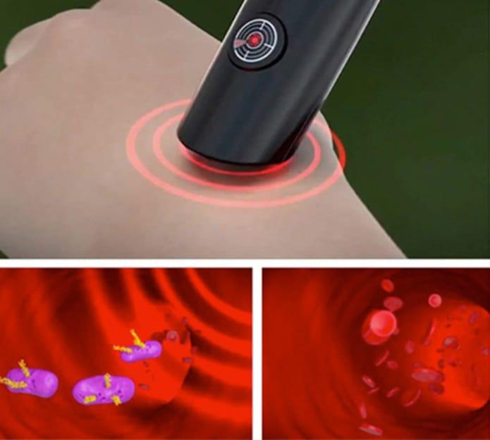 Mosquito Helper, pero za odpravljanje srbenja po piku
